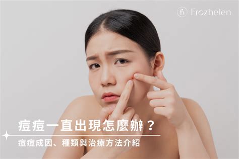 下巴人中長痘痘|下巴一直長痘痘該怎麼改善？看懂下巴痘痘的身體警訊…